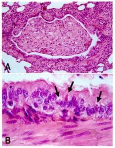Staupe Virus Hund unter dem Mikroskop